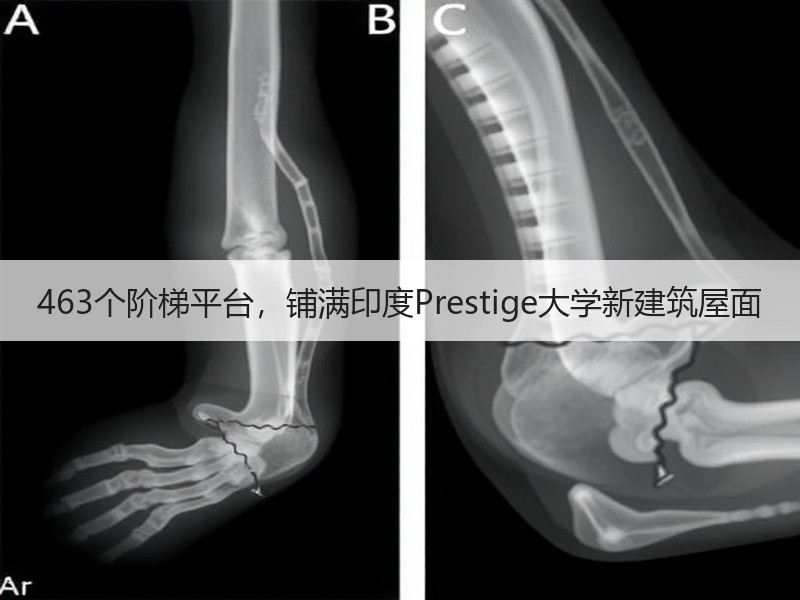 463个阶梯平台，铺满印度Prestige大学新建筑屋面